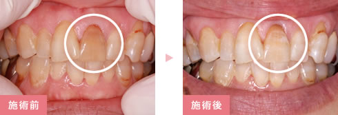 施術前後の比較写真1