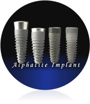 インプラントイメージ